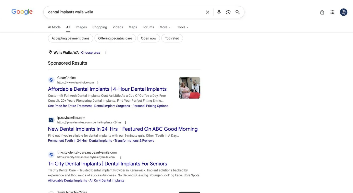 Sponsored Google results for dental implants Walla Walla with three competing advertisers